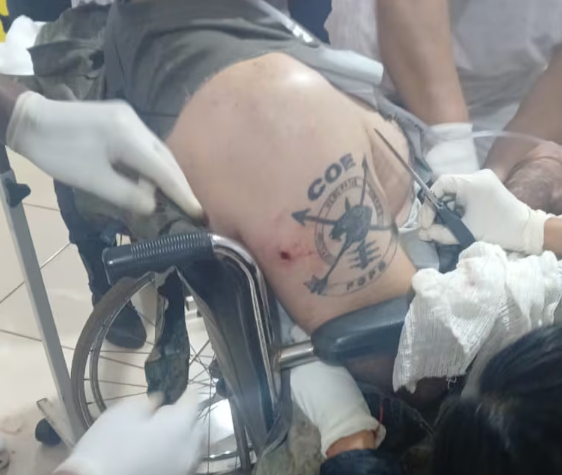 EMBOSCADA EN EL NORTE: JEFE POLICIAL LUCHA POR SU VIDA TRAS VIOLENTO ATAQUE ARMADO